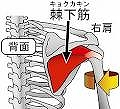 棘下筋２.jpg