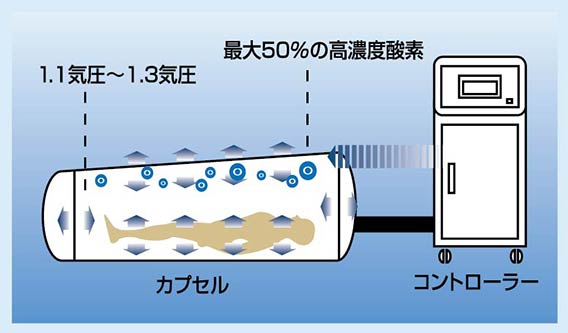 酸素カプセルについて